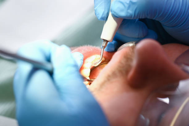 Best Cracked Tooth Emergency Dentist  in Port Byron, IL
