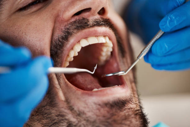 Best Emergency Tooth Extraction  in Port Byron, IL