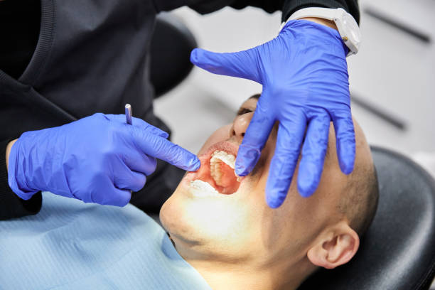 Best Knocked-Out Tooth Emergency  in Port Byron, IL