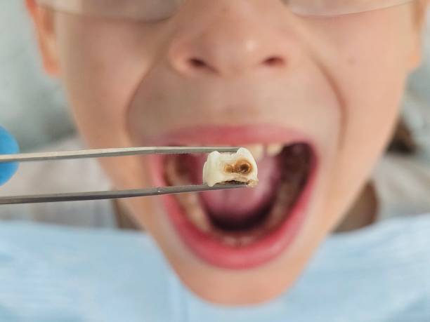 Best Tooth Infection Emergency Dentist  in Port Byron, IL